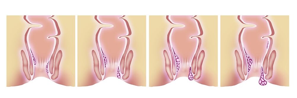 Gelarex eficaz en todas as fases